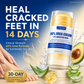 🔥 OFFERTA – Crema piedi anti-screpolature, idratazione intensiva in un solo gesto! 👣✨