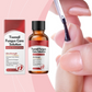 ✨ Il Regalo Perfetto per le Tue Unghie – 50% di SCONTO! Essenza Riparatrice che Nutre, Rinforza e Ripara le Unghie Danneggiate! 🌟💅