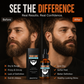 🧔💧 Olio essenziale nutriente per la cura della barba – idrata, ammorbidisce e nutre! 🌿✨